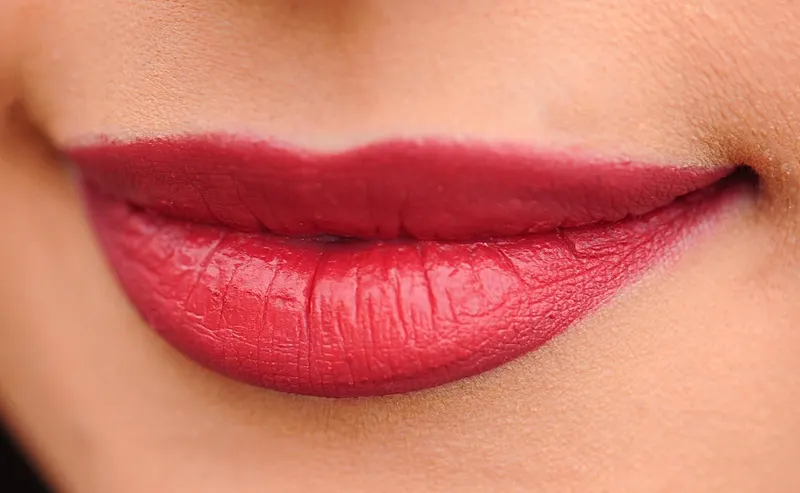 Cold Sores