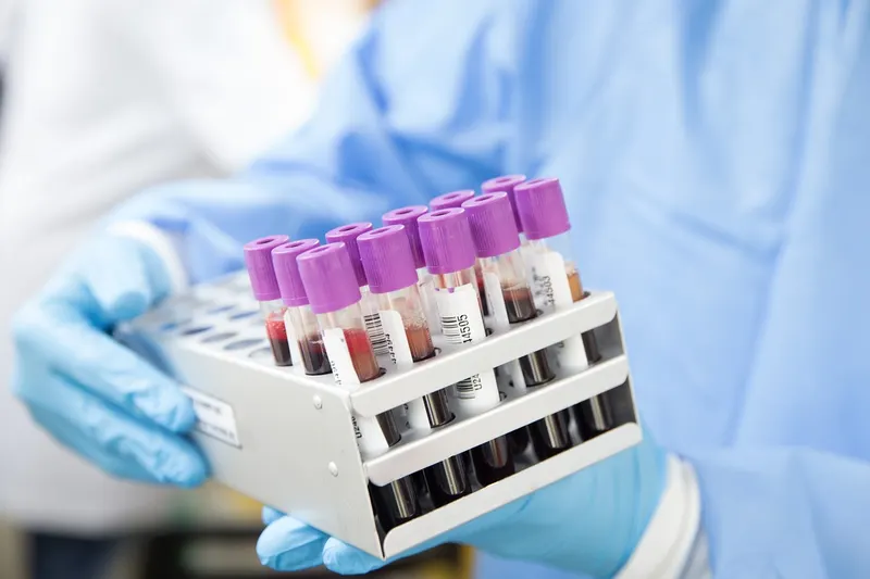 Sexually Transmitted Infections (STIs)