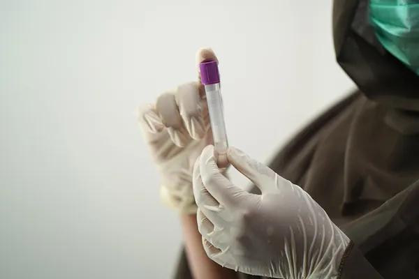 Testosterone Testing treatment